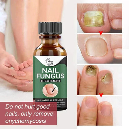 Nail Fungus Treatment Serum